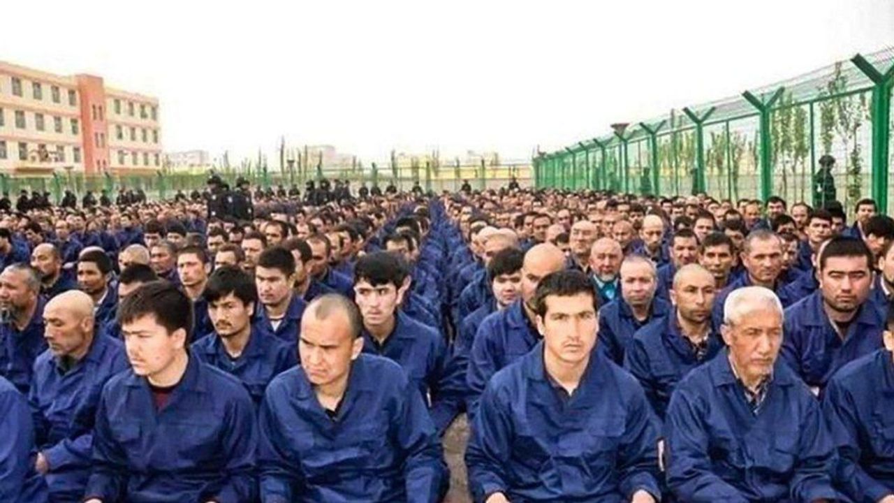 Yılda 25 Bin Uygur’un Organını Çalıp Satıyor!