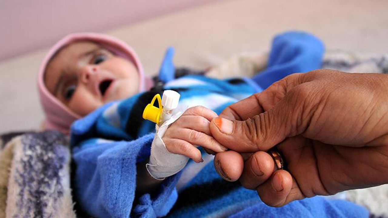UNICEF: Yemen'de 12 Milyon Çocuk Acil Yardıma Muhtaç