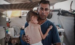 Açlıktan Ölenlerin Sayısı 303’e Çıktı, Aralarında 117 Çocuk Var