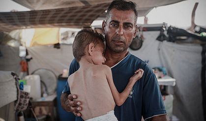 Açlıktan Ölenlerin Sayısı 303’e Çıktı, Aralarında 117 Çocuk Var