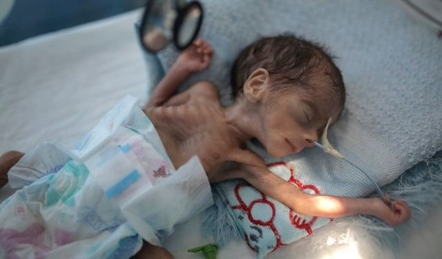 "Yemen'de Bir Nesil Yok Olma Tehlikesiyle Karşı Karşıya!"