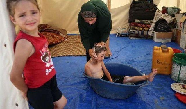 UNRWA: Gazze Şeridi’nde Temizlik Maddesi Yokluğu Had Safhada