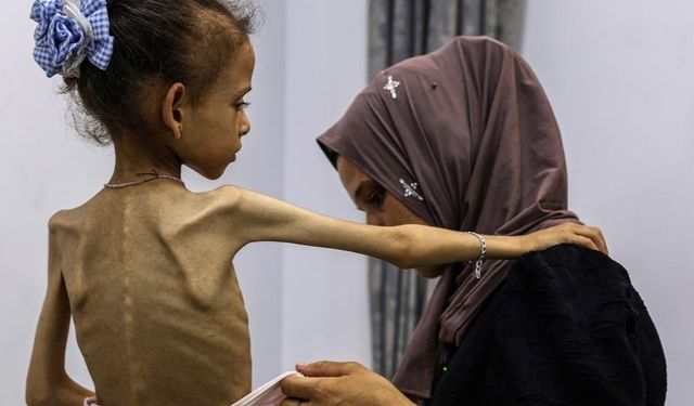 UNRWA: Yardım Girişine Derhal İzin Verilerek Gazze’deki Açlık Durdurulabilir