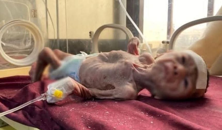 İşgal Rejiminin Aç Bırakma Politikası Yüzünde 500 Bebek Hastanelerde Gözlem Altında